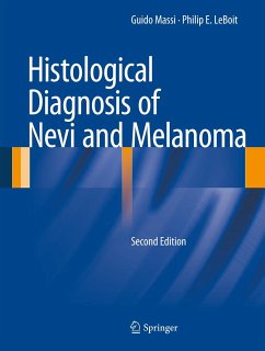 Histological Diagnosis of Nevi and Melanoma (eBook, PDF) - Massi, Guido; Leboit, Philip E.