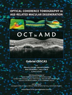 Optical Coherence Tomography in Age-Related Macular Degeneration (eBook, PDF) - Coscas, Gabriel