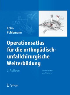 Operationsatlas für die orthopädisch-unfallchirurgische Weiterbildung (eBook, PDF) - Kohn, Dieter; Pohlemann, Tim