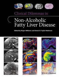 Clinical Dilemmas in Non-Alcoholic Fatty Liver Disease - Williams, Roger;Taylor-Robinson, Simon D.