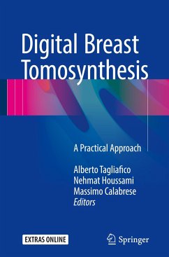 Digital Breast Tomosynthesis