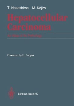 Cover Hepatocellular Carcinoma (eBook, PDF)