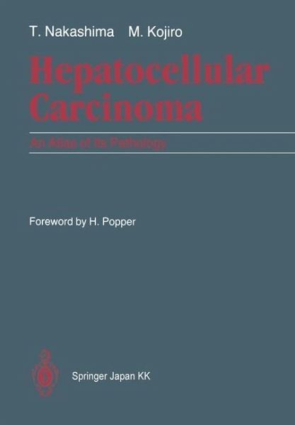 Hepatocellular Carcinoma (eBook, PDF) Hepatocellular Carcinoma (eBook, PDF)