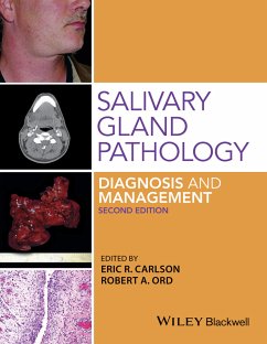 Salivary Gland Pathology (eBook, PDF) - Carlson, Eric R.; Ord, Robert A.