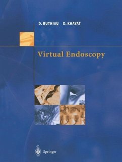 Virtual Endoscopy (eBook, PDF) - Buthiau, Didier; Khayat, David