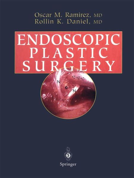 Endoscopic Plastic Surgery (eBook, PDF) Endoscopic Plastic Surgery (eBook, PDF)