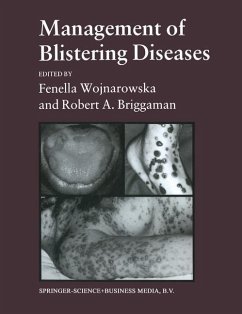 Cover Management of Blistering Diseases (eBook, PDF)