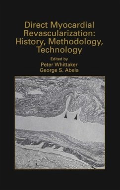 Direct Myocardial Revascularization: History, Methodology, Technology (eBook, PDF)