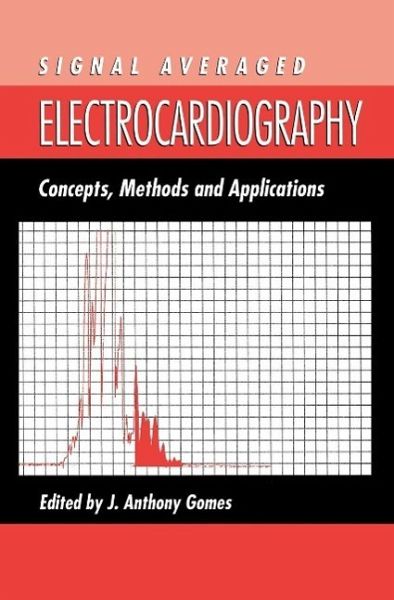 Signal Averaged Electrocardiography (eBook, PDF) Signal Averaged Electrocardiography (eBook, PDF)