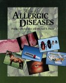 Atlas of Allergic Diseases (eBook, PDF)