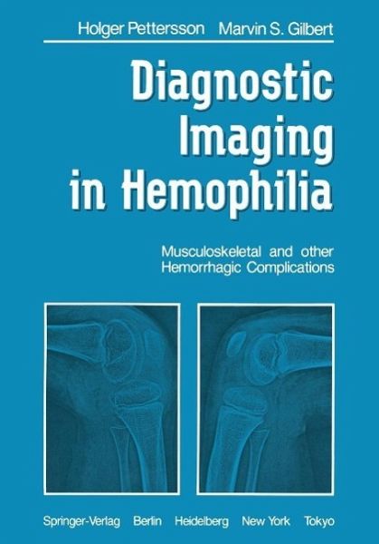 Diagnostic Imaging in Hemophilia (eBook, PDF) Diagnostic Imaging in Hemophilia (eBook, PDF)