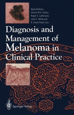 Diagnosis and Management of Melanoma in Clinical Practice (eBook, PDF)