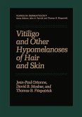 Vitiligo and Other Hypomelanoses of Hair and Skin (eBook, PDF)
