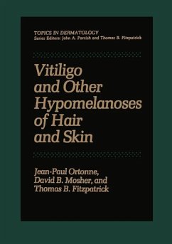 Vitiligo and Other Hypomelanoses of Hair and Skin (eBook, PDF) - Ortonne, Jean-Paul