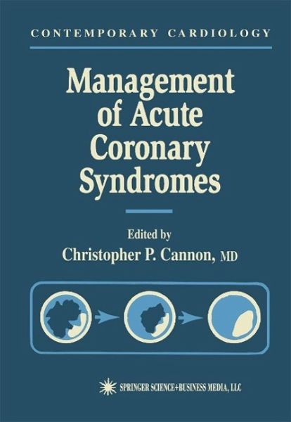 Management of Acute Coronary Syndromes (eBook, PDF) Management of Acute Coronary Syndromes (eBook, PDF)