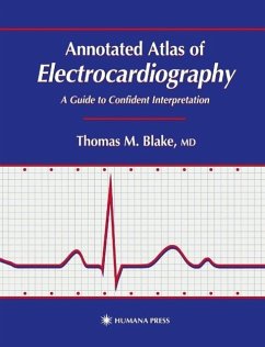 Annotated Atlas of Electrocardiography (eBook, PDF) - Blake, Thomas M.