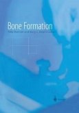 Bone Formation (eBook, PDF)