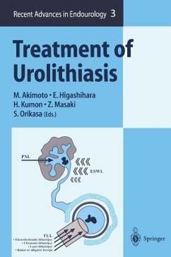 Cover Treatment of Urolithiasis (eBook, PDF)