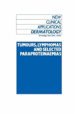 Tumours, Lymphomas and Selected Paraproteinaemias (eBook, PDF)