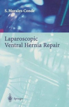 Laparoscopic Ventral Hernia Repair (eBook, PDF) - Morales-Conde, Salvador