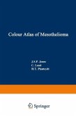 Colour Atlas of Mesothelioma (eBook, PDF)