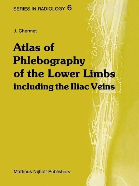 Atlas of Phlebography of the Lower Limbs (eBook, PDF) Atlas of Phlebography of the Lower Limbs (eBook, PDF)