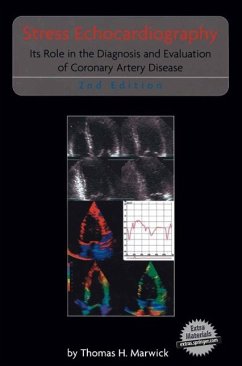 Cover Stress Echocardiography (eBook, PDF)