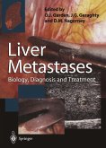 Liver Metastases (eBook, PDF)