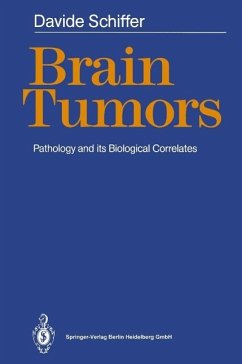 Brain Tumors (eBook, PDF) - Schiffer, Davide
