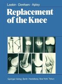 Replacement of the Knee (eBook, PDF)