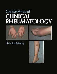 Colour Atlas of Clinical Rheumatology (eBook, PDF) - Bellamy, N.