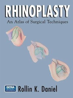 Cover Rhinoplasty (eBook, PDF)