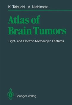 Atlas of Brain Tumors (eBook, PDF) - Tabuchi, Kazuo; Nishimoto, Akira