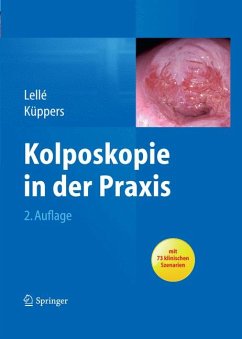 Kolposkopie in der Praxis (eBook, PDF) - Lellé, Ralph J.; Küppers, Volkmar