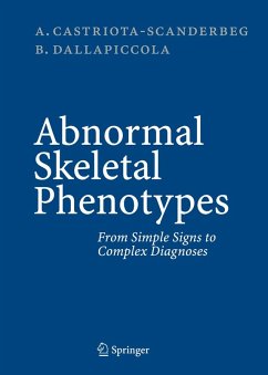 Abnormal Skeletal Phenotypes (eBook, PDF) - Castriota-Scanderbeg, Alessandro; Dallapiccola, Bruno