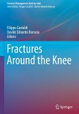 Fractures Around the Knee