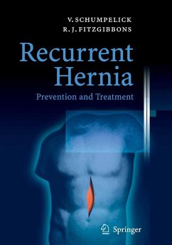 Recurrent Hernia (eBook, PDF)