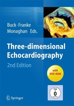 Three-dimensional Echocardiography (eBook, PDF)