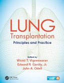 Lung Transplantation (eBook, PDF)