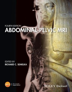 Cover Abdominal-Pelvic MRI (eBook, PDF)