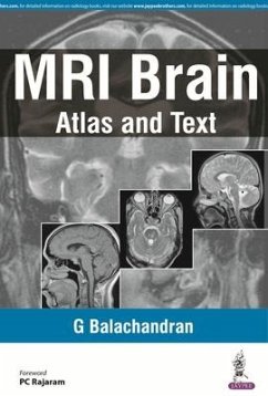 Cover MRI Brain