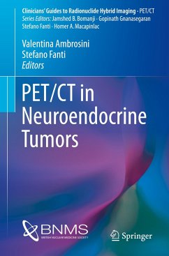 PET/CT in Neuroendocrine Tumors