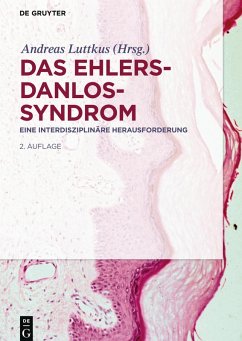 Cover Das Ehlers-Danlos-Syndrom