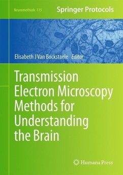 Transmission Electron Microscopy Methods for Understanding the Brain