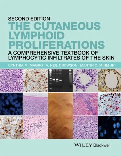 The Cutaneous Lymphoid Proliferations (eBook, ePUB) - Magro, Cynthia M.; Crowson, A. Neil; Mihm, Martin C.