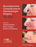 Reconstructive Conundrums in Dermatologic Surgery (eBook, ePUB)