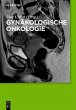 Gynäkologische Onkologie (eBook, PDF) - Bild 1
