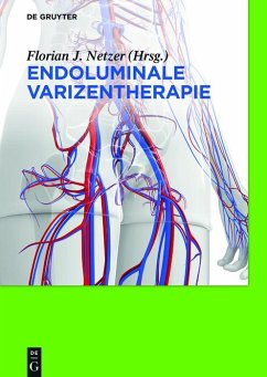 Endoluminale Varizentherapie (eBook, ePUB) - Netzer, Florian Johannes