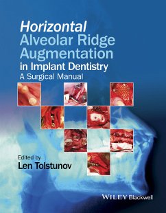 Horizontal Alveolar Ridge Augmentation in Implant Dentistry (eBook, PDF) - Tolstunov, Len