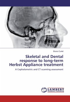 Skeletal and Dental response to long-term Herbst Appliance treatment - Curiel, Bruno